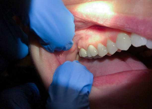 Best Emergency Dental Services for Seniors in Evergreen Park, IL